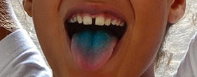 langue bleue